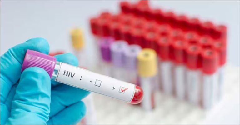hiv-representational